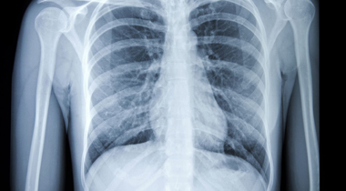 radiology services in uganda